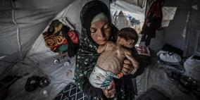 11 حالة وفاة نتيجة المجاعة وسوء التغذية في غزة