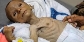 الأونروا: طفل من كل ثلاثة بغزة لم يتناول طعاما خلال 24 ساعة