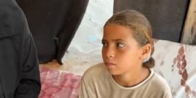 فخ “كيس الإندومي”… هكذا دمرت مخلفات الاحتلال حياة طفلة في غزة