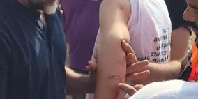 مستوطنون يعتدون على متضامنين قرب دير استيا