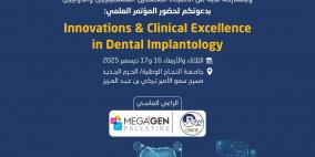 خاص | جامعة النجاح تعقد المؤتمر الدولي لزراعة الأسنان في فلسطين