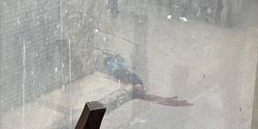 إصابة خطيرة برصاص الاحتلال في مخيم قلنديا