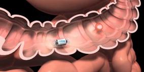 كاميرا طبية تصور داخل جسم الإنسان دون الحاجة إلى أشعة