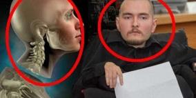 تغيير كبير في أول عملية زراعة رأس بالعالم