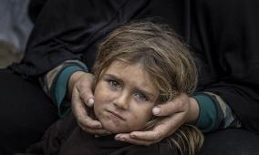 "اليونيسف" تحذر من تفشي الأمراض بين أطفال غزة