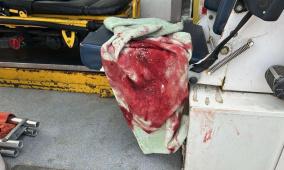 إصابة طفلين برصاص الاحتلال شرق مخيم المغازي وسط غزة