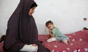 "جمعية بيت لحم للتأهيل" تبدأ حصر بيانات الأطفال مبتوري الأطراف لتوفير أطراف صناعية متطورة