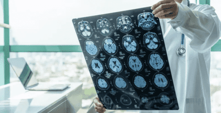 تقدّم طبي لافت.. قطرات أنفية لعلاج سرطان خطير