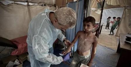 الطب الوقائي بغزة يكشف لراية طبيعة الفيروس الفتاك المنتشر حاليا