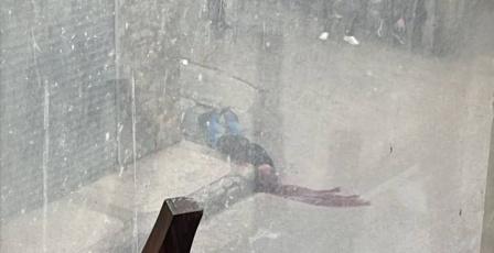 إصابة خطيرة برصاص الاحتلال في مخيم قلنديا