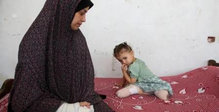 عدد الأطفال مبتوري الأطراف في غزة الأكبر بالعالم: الذخائر غير المنفجرة تهدد جهود إعادة الإعمار