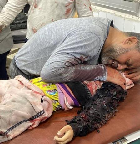 شهيد وإصابات في قصف ونيران الاحتلال بمناطق متفرقة من قطاع غزة