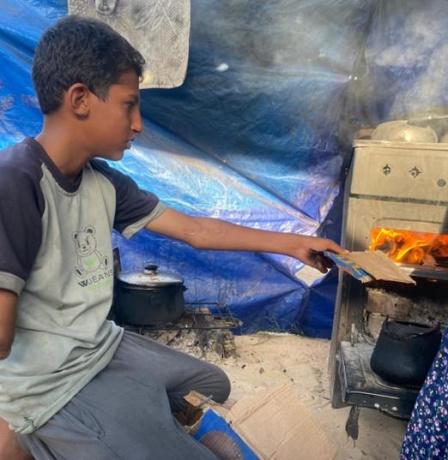 أحمد… طفلٌ خرج من بين الرماد يحمل نصف جسدٍ وقلبًا كاملًا