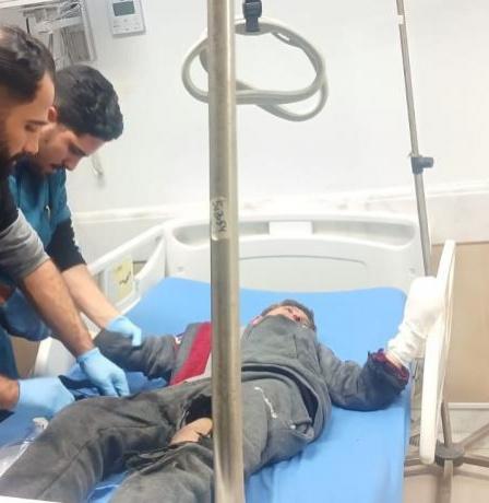 إصابة طفل بانفجار جسم من مخلفات الاحتلال شمال غزة