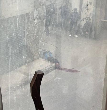 إصابة خطيرة برصاص الاحتلال في مخيم قلنديا