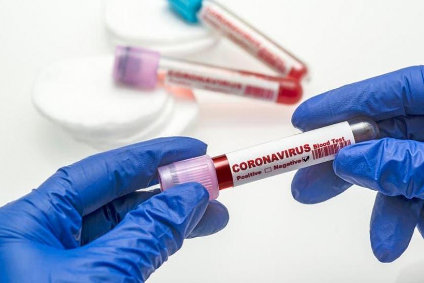 فحصات كورونا