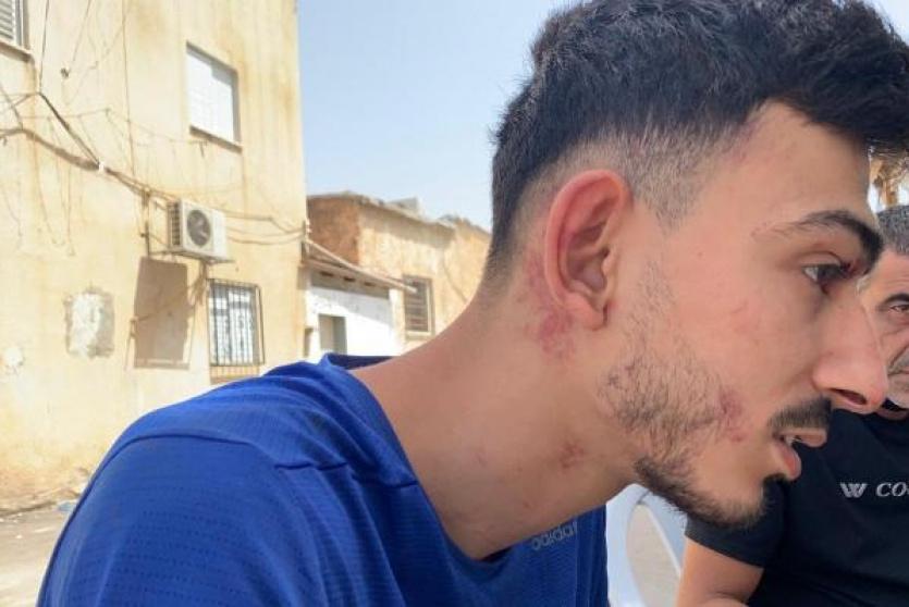 شاب من اللد تعرض لاعتداء من قبل الشرطة
