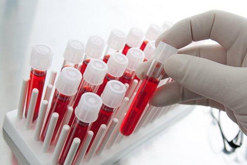 فحصات كورونا 