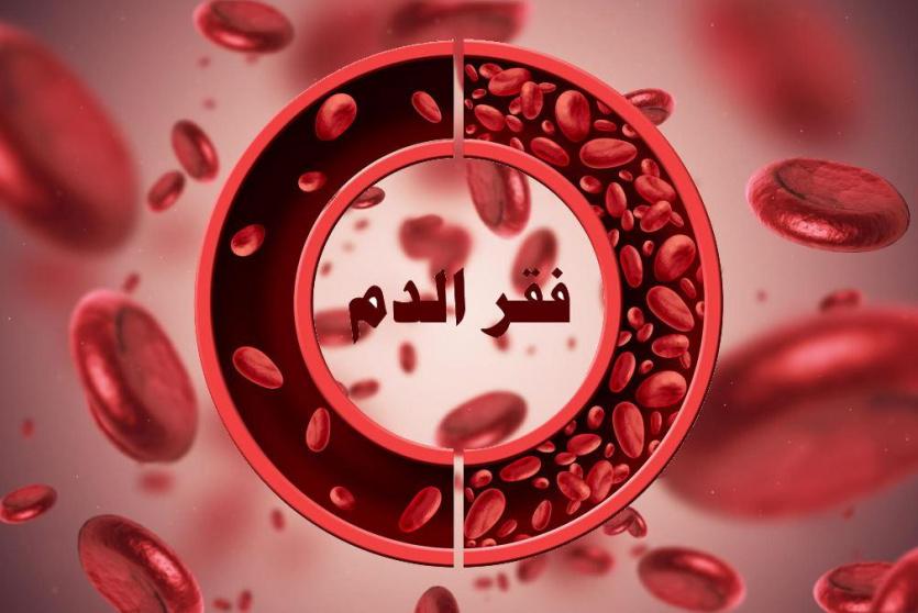 فقر الدم