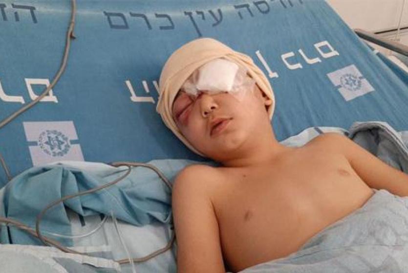 الطفل مالك عيسى