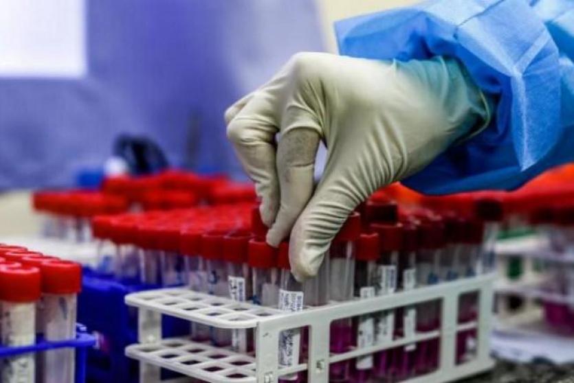 فحصات كورونا 