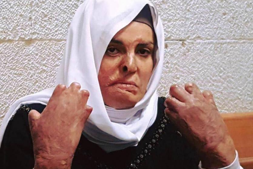الأسيرة الجريحة إسراء الجعابيص