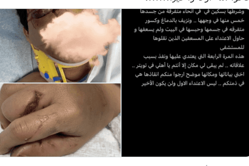 الضحية منى انقذوها