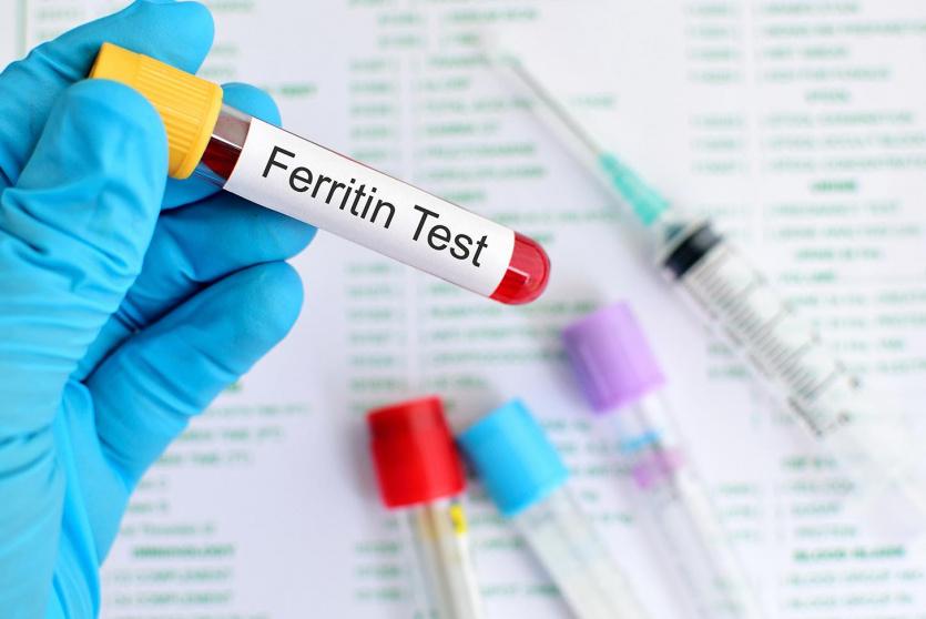 فحص دم - صورة تعبيرية 