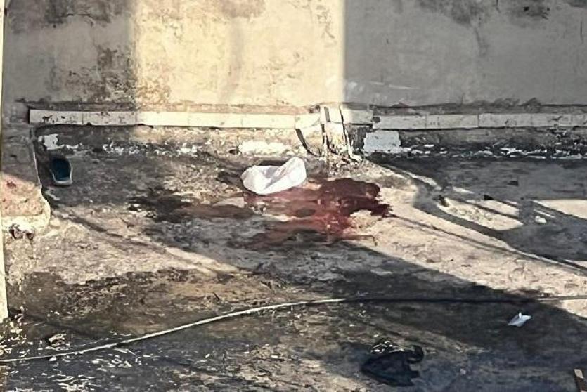 مكان ارتقاء الطفلة الشهيدة جنى زكارنة 