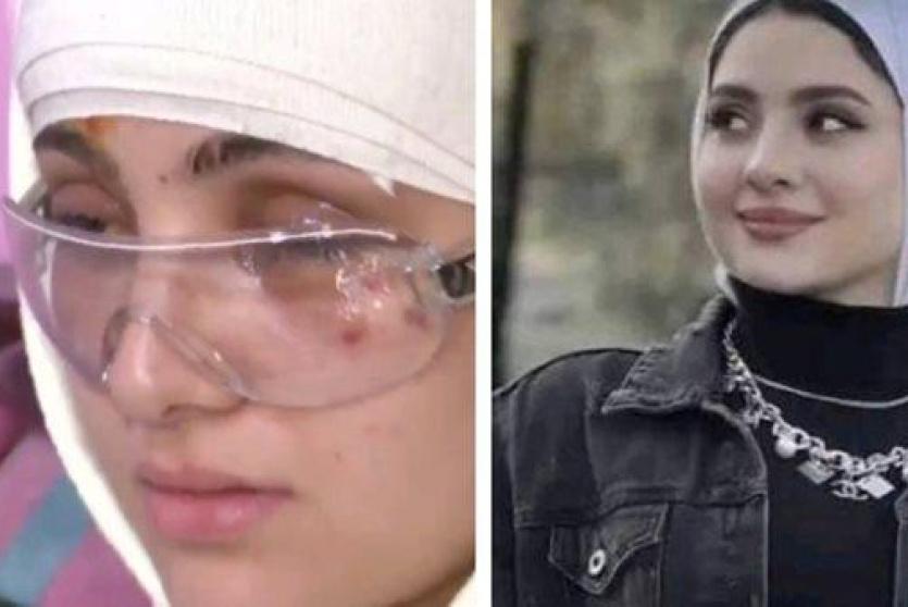 البلوجر سارة محمد