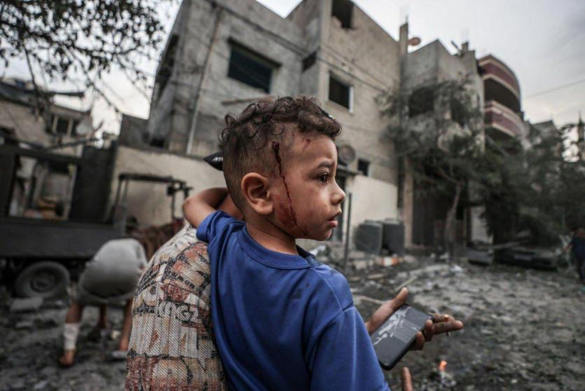 حصيلة: 704 شهداء ونحو 3900 مصاب في غزة والضفة