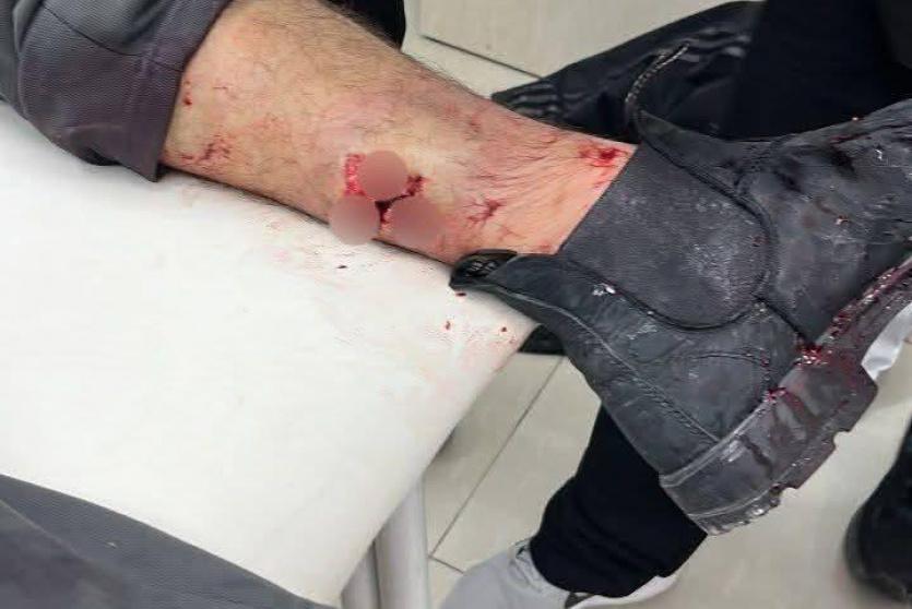 إصابتان برصاص الاحتلال في بلدة الرام